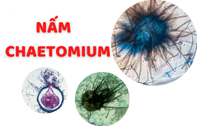 Nấm đối kháng Chaetomium: diệt trừ nấm hại cho cây trồng