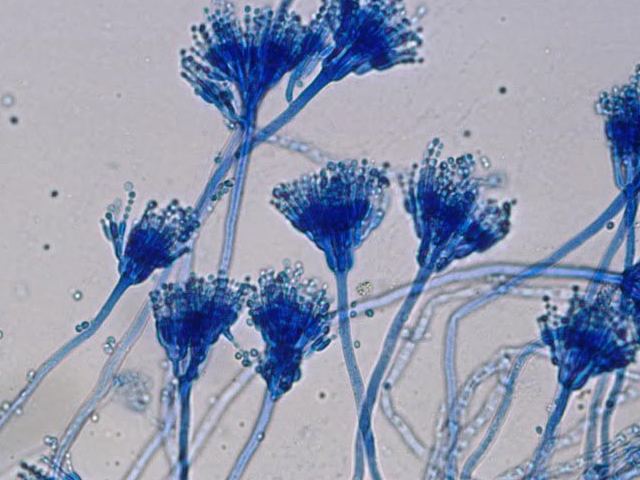 Aspergillus Oryzae là một loại nấm sợi, có màu sắc từ vàng đến nâu